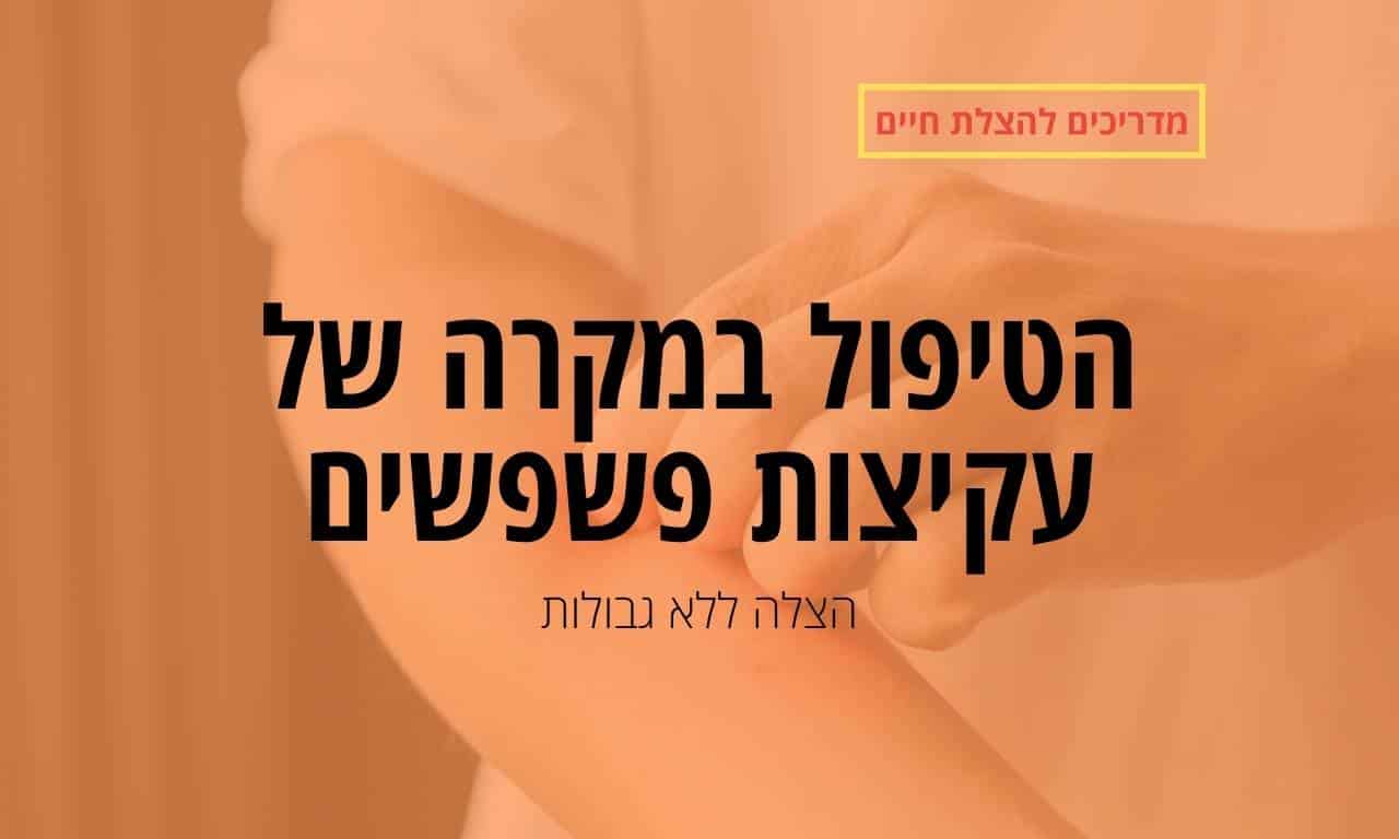 הטיפול במקרה של עקיצות פשפשים
